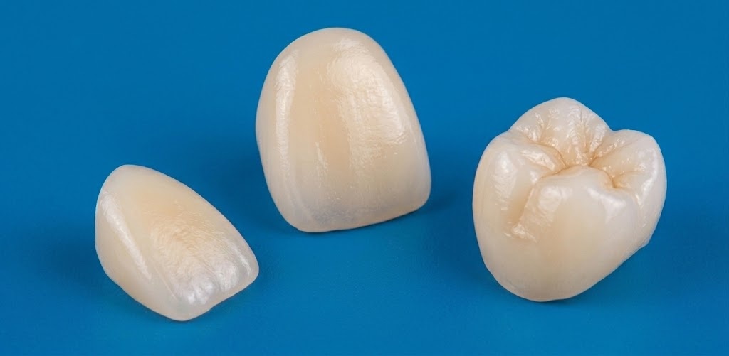 Corones i carilla de zirconi sobre fons blau.
